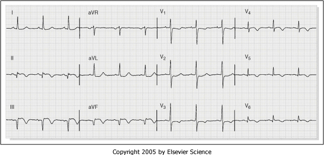 Fig.1