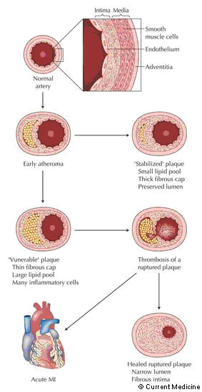 Fig.2